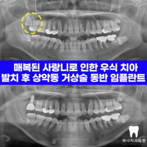 울산삼산동치과