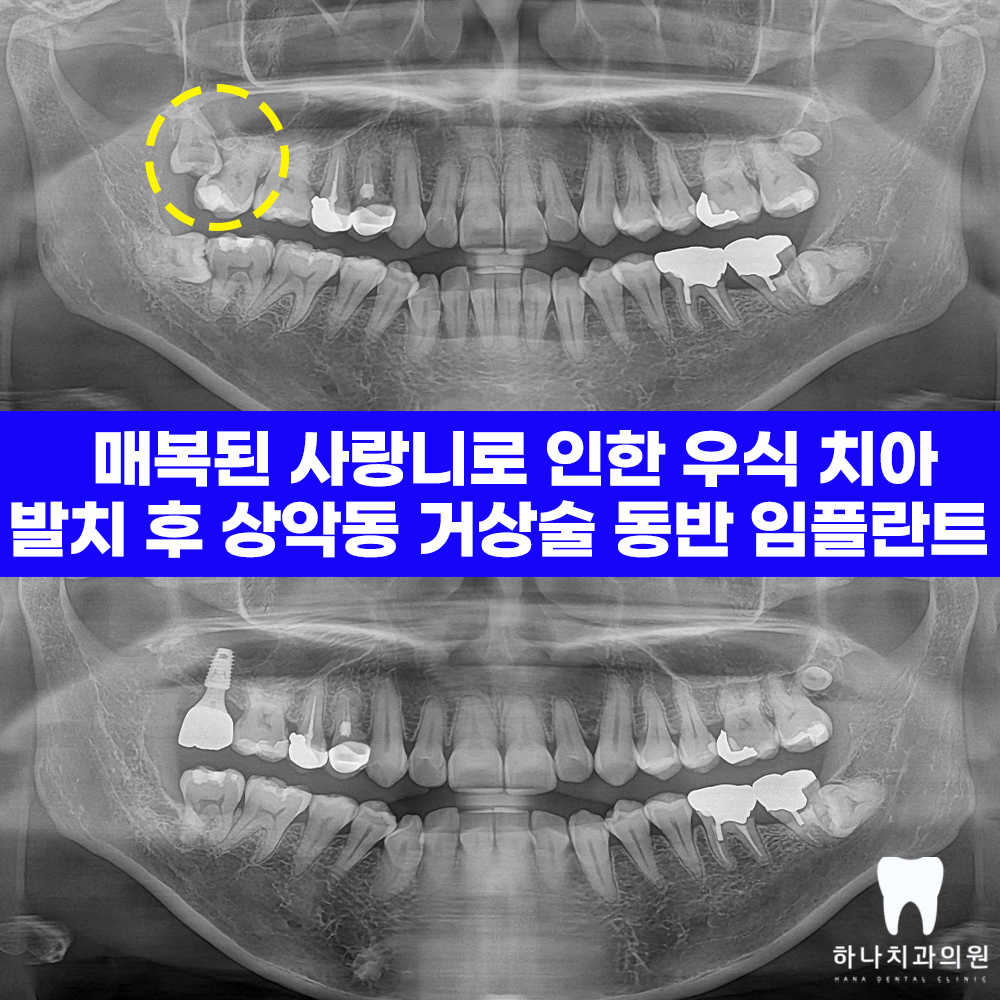 삼산잘하는치과 