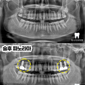 울산달동하나치과