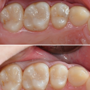 울산삼산동치과