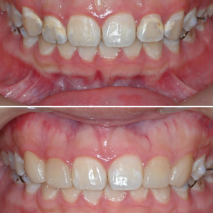 울산삼산동치과