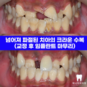 울산삼산동치과