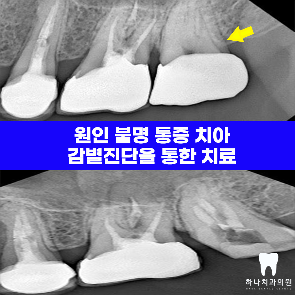 울산야간진료치과 