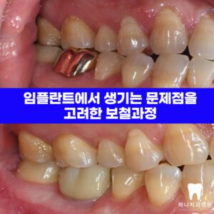 울산삼산동치과