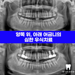 울산달동하나치과