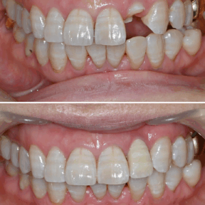 울산삼산동치과