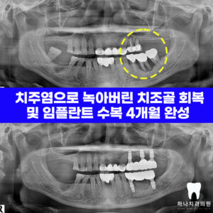 울산삼산동치과