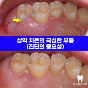 울산삼산동치과