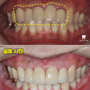 울산삼산동치과
