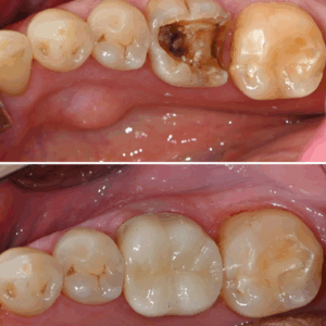 울산삼산동치과