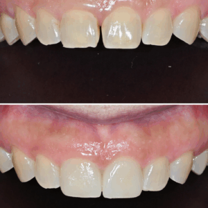 울산달동하나치과