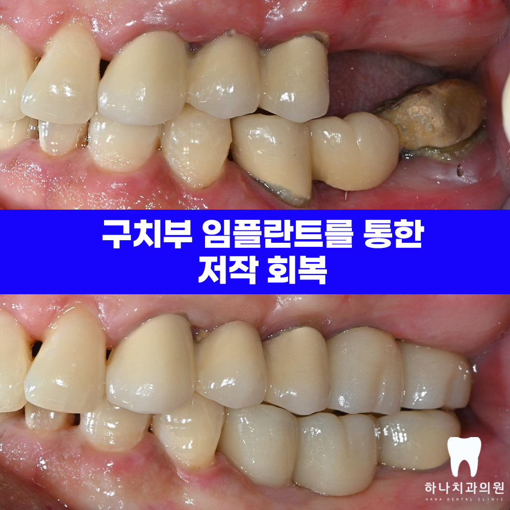 울산삼산치과 