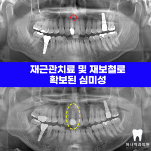 울산달동하나치과