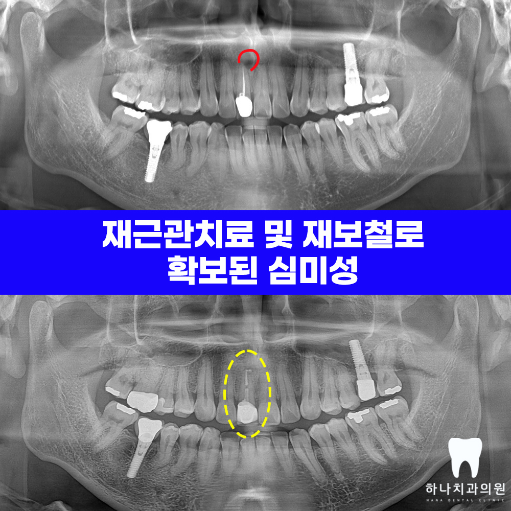 울산달동하나치과 