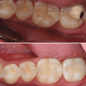 울산달동하나치과