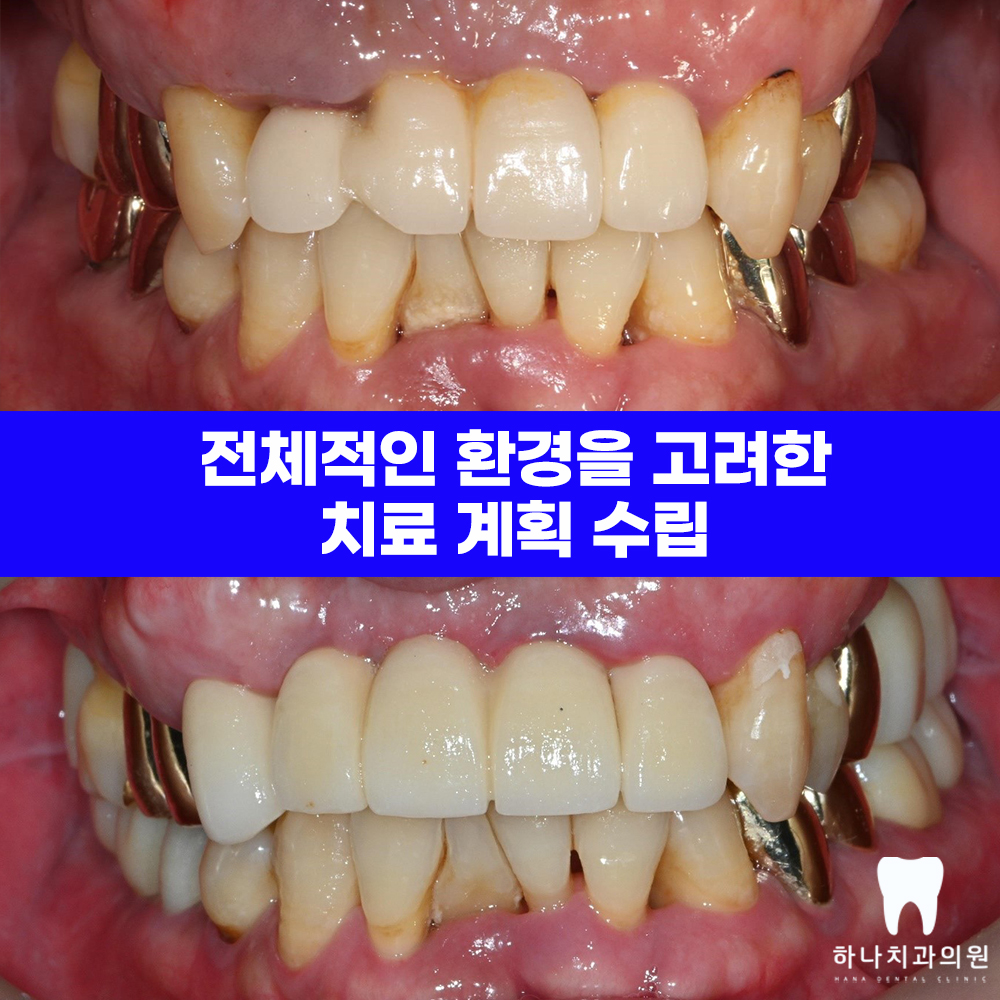 울산삼산동치과 
