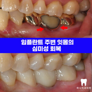 울산신정동치과