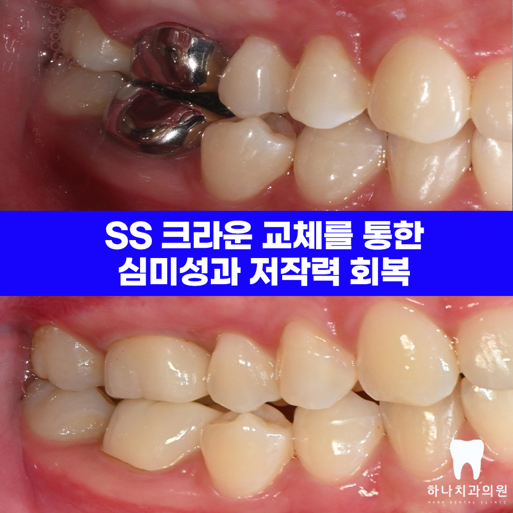 울산삼산치과