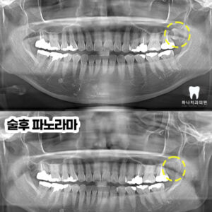 울산달동하나치과