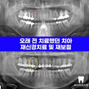 울산신정동치과