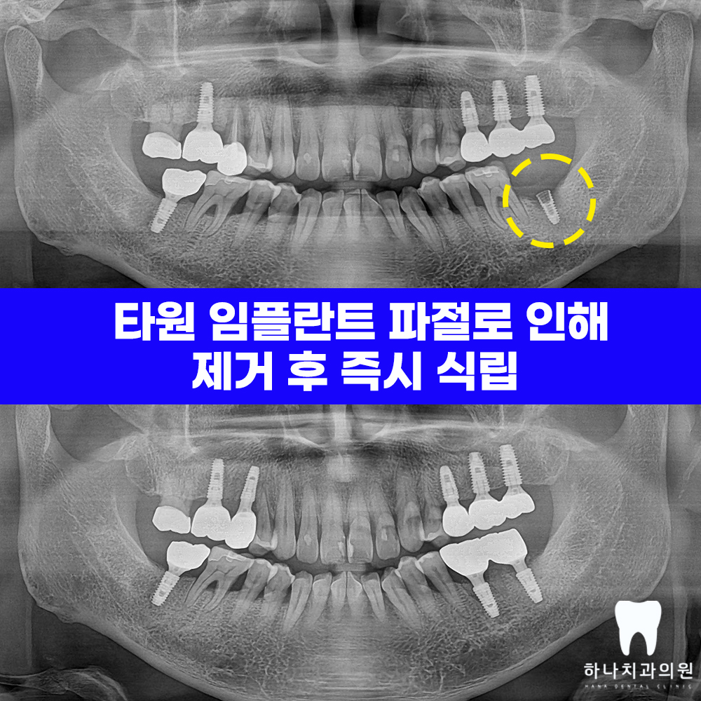 울산삼산동치과