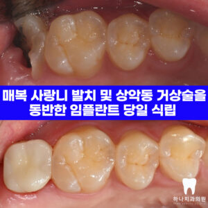 울산달동하나치과