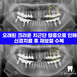 울산삼산동치과