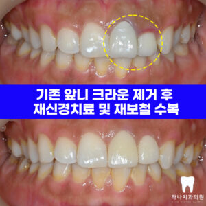 울산삼산동치과