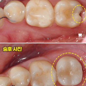 울산신정동치과