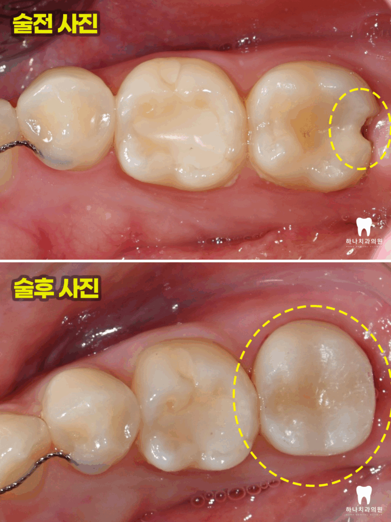 울산신정동치과