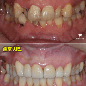 울산삼산동치과