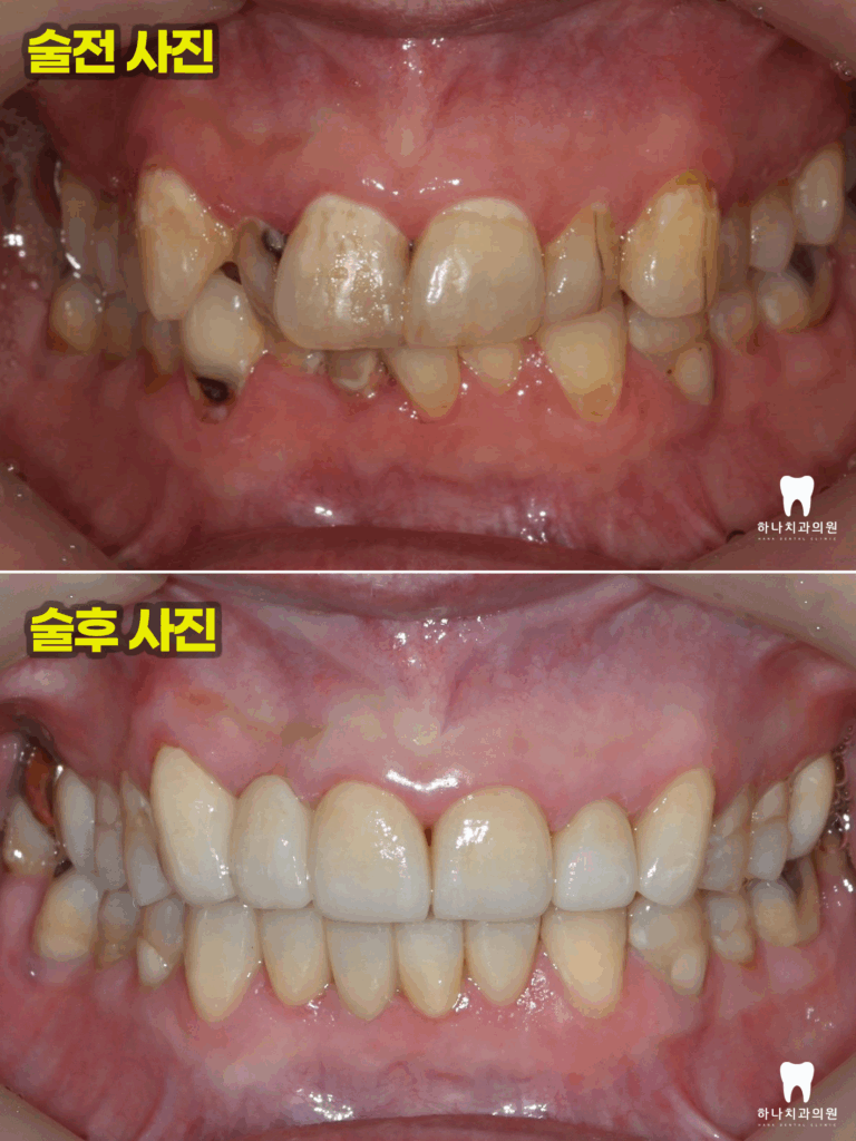 울산삼산동치과 