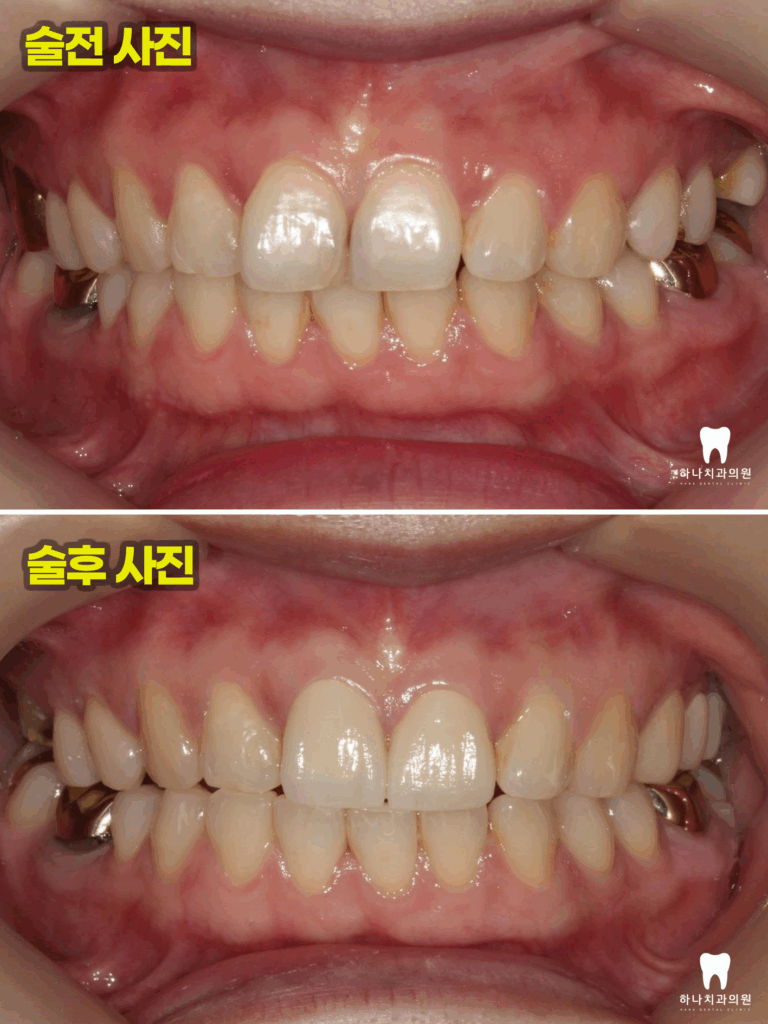 울산신정동치과