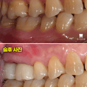 울산달동하나치과