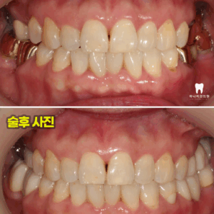 울산삼산동치과