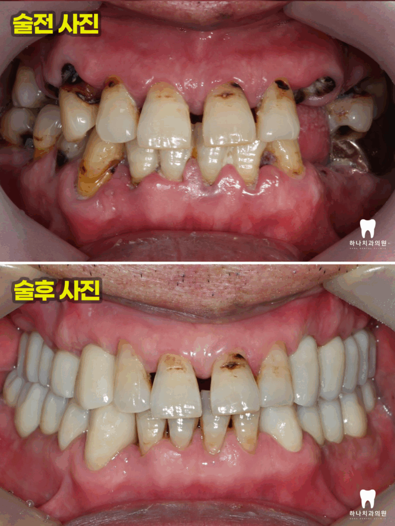 울산삼산치과 