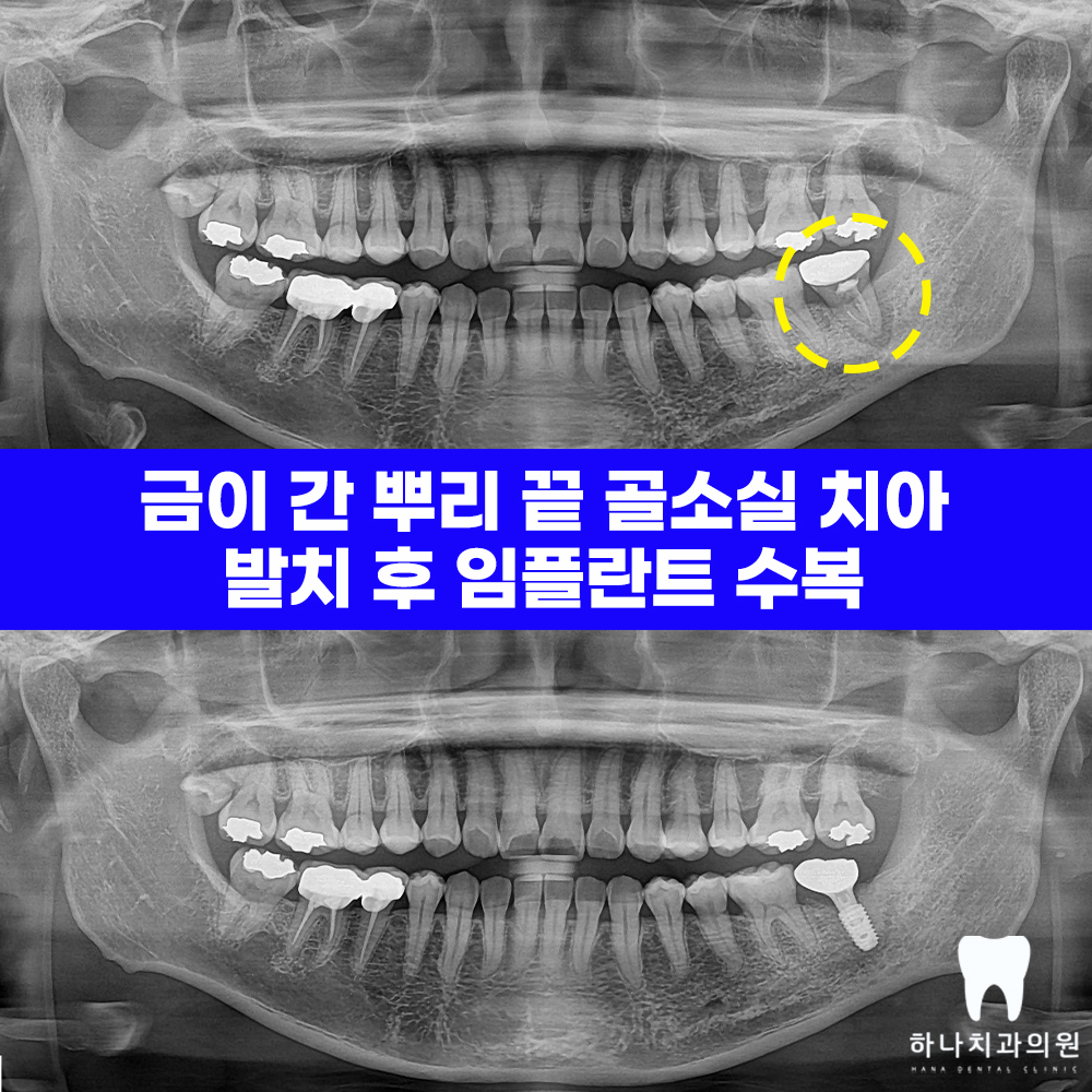 울산달동하나치과 