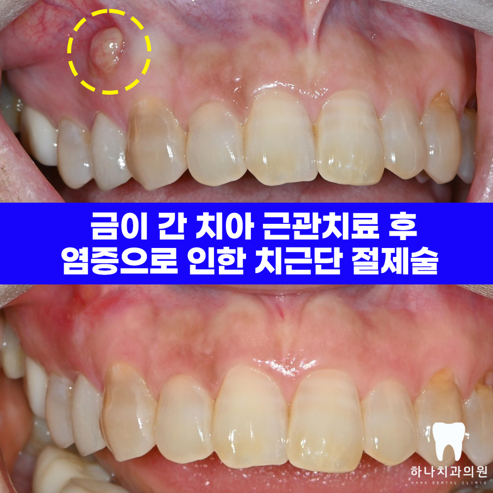 울산삼산동치과 