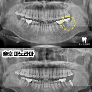 울산삼산동치과
