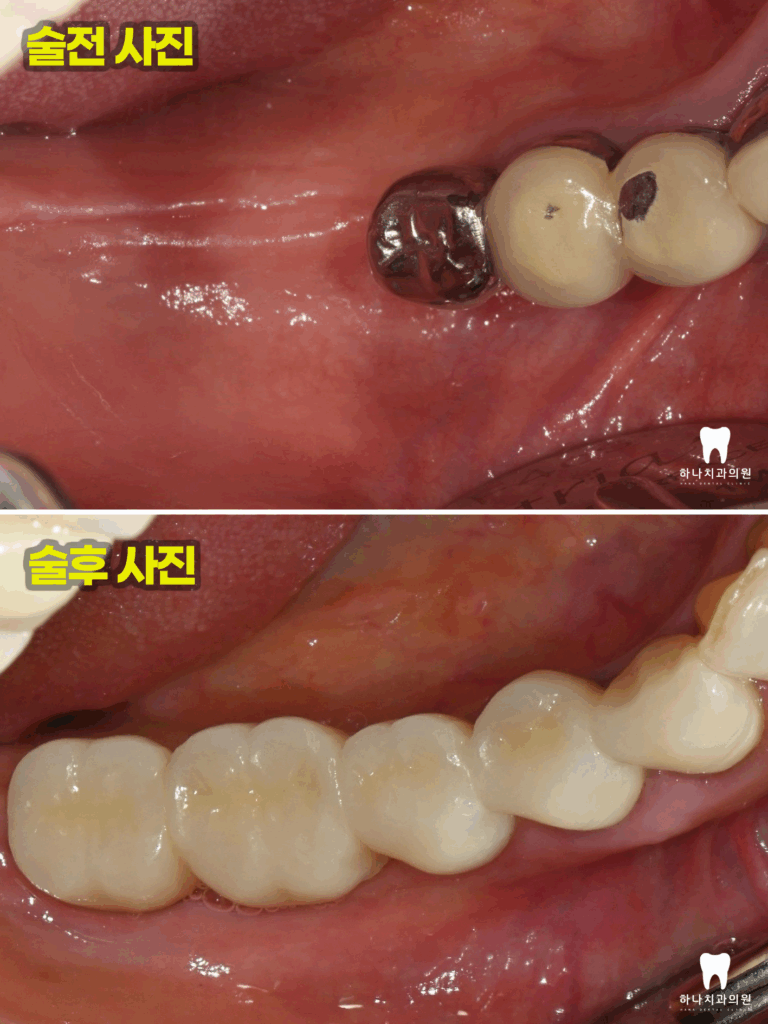 울산신정동치과