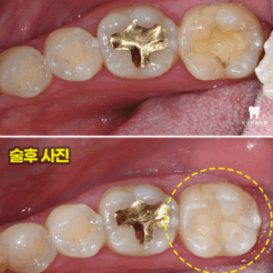 울산삼산동치과
