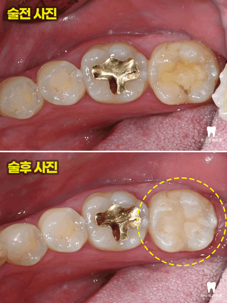 울산삼산동치과 