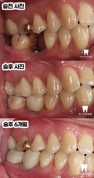 울산삼산동치과 