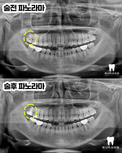 울산삼산동치과 