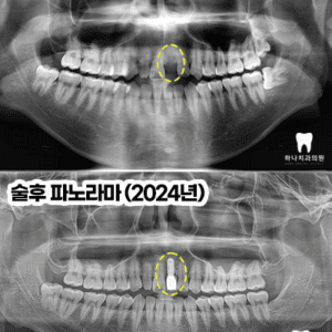 울산삼산동치과