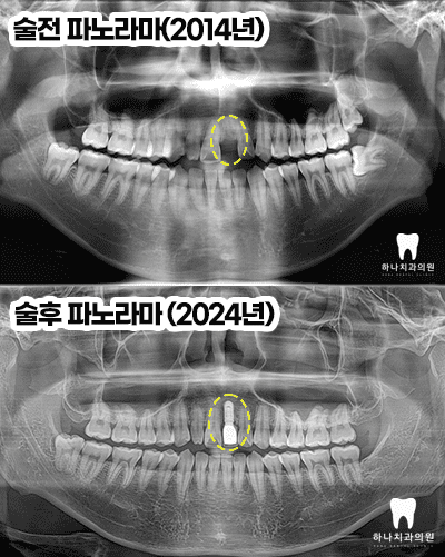 울산삼산동치과 