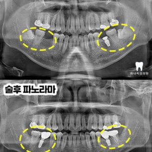 울산삼산동치과
