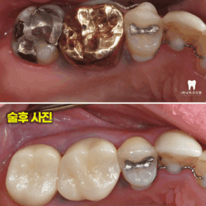 울산신정동치과