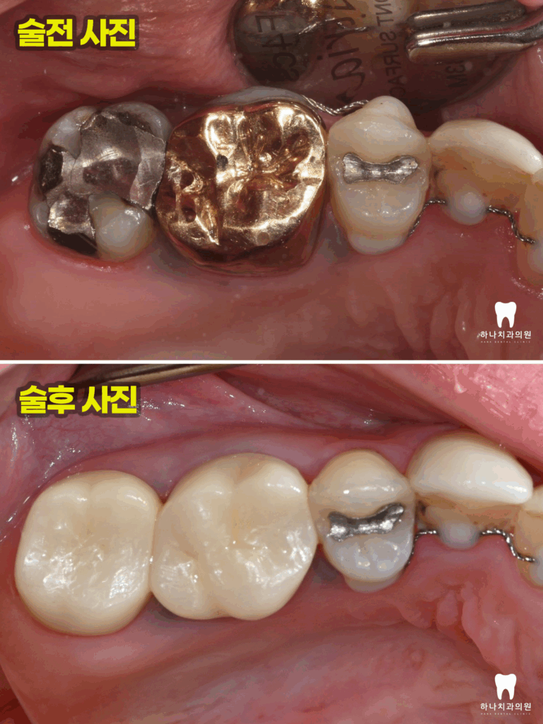 울산신정동치과 
