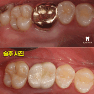 울산삼산동치과